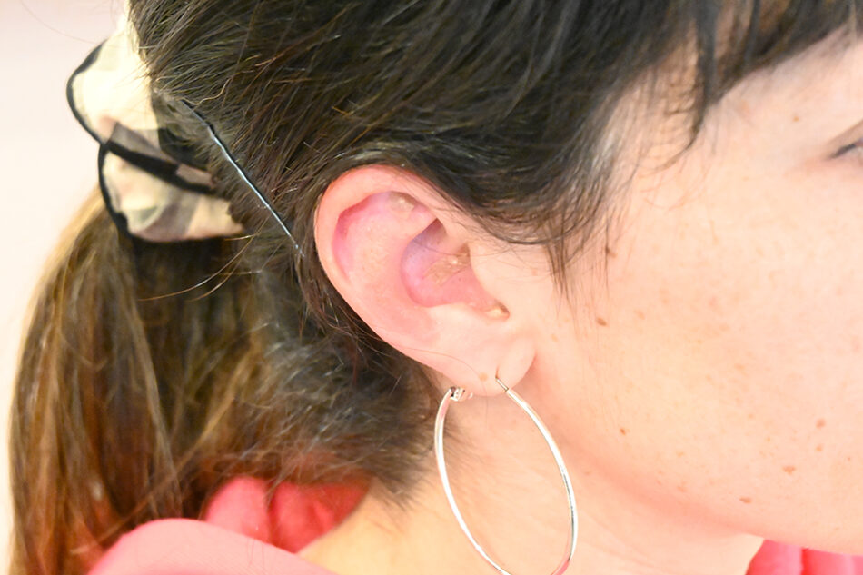 Ear Acupressure Diet Salon Pesca